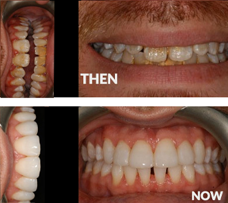 Severe Dental Phobia at Start Smiling Dentist in Essex